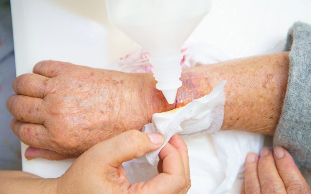 wound cleaning