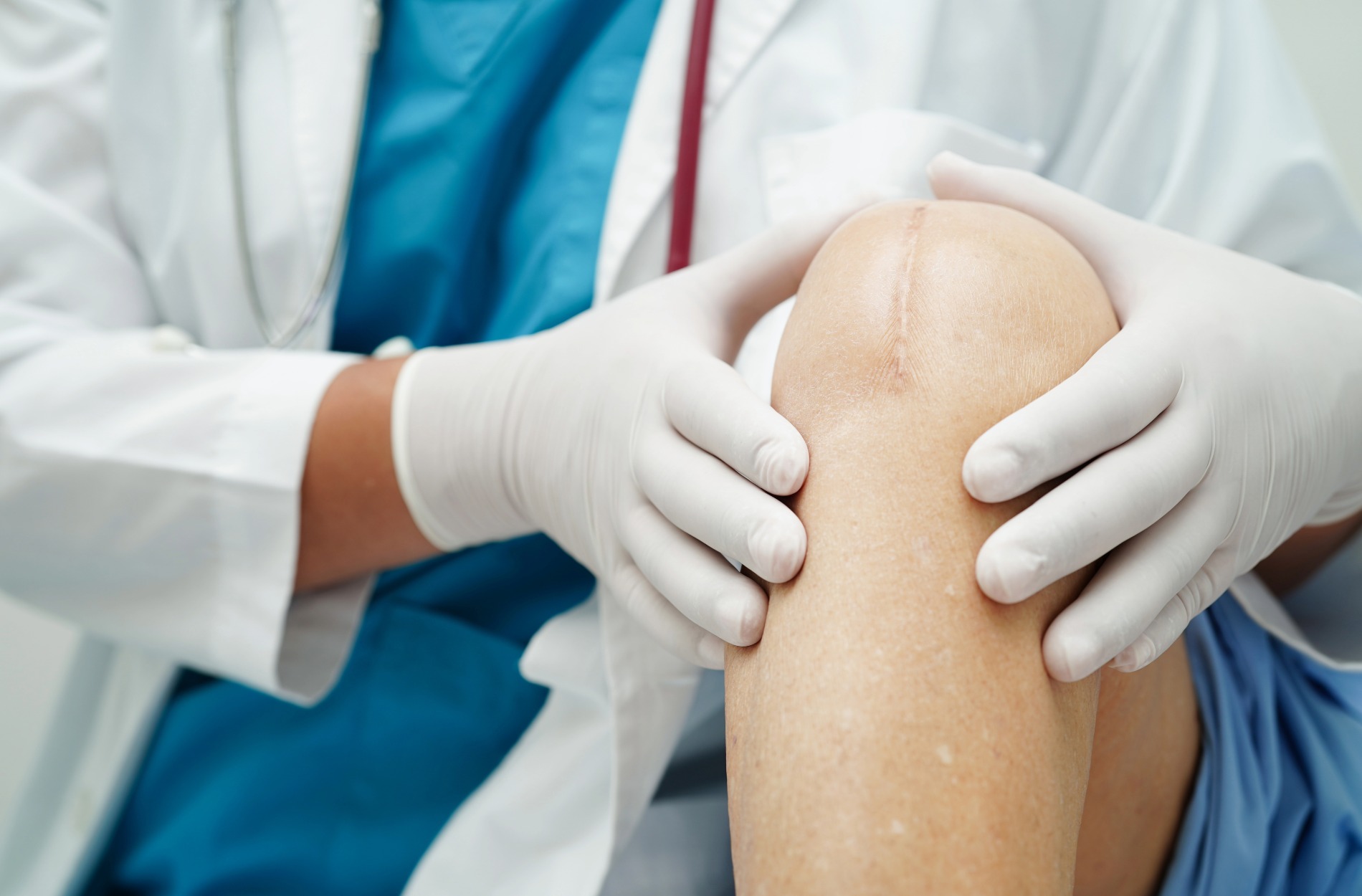 Signs Your Current Wound Treatment Isn’t Working